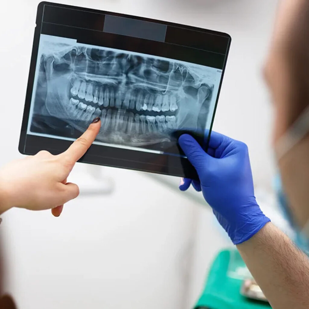 Dental-OPG-Digital-X-Ray