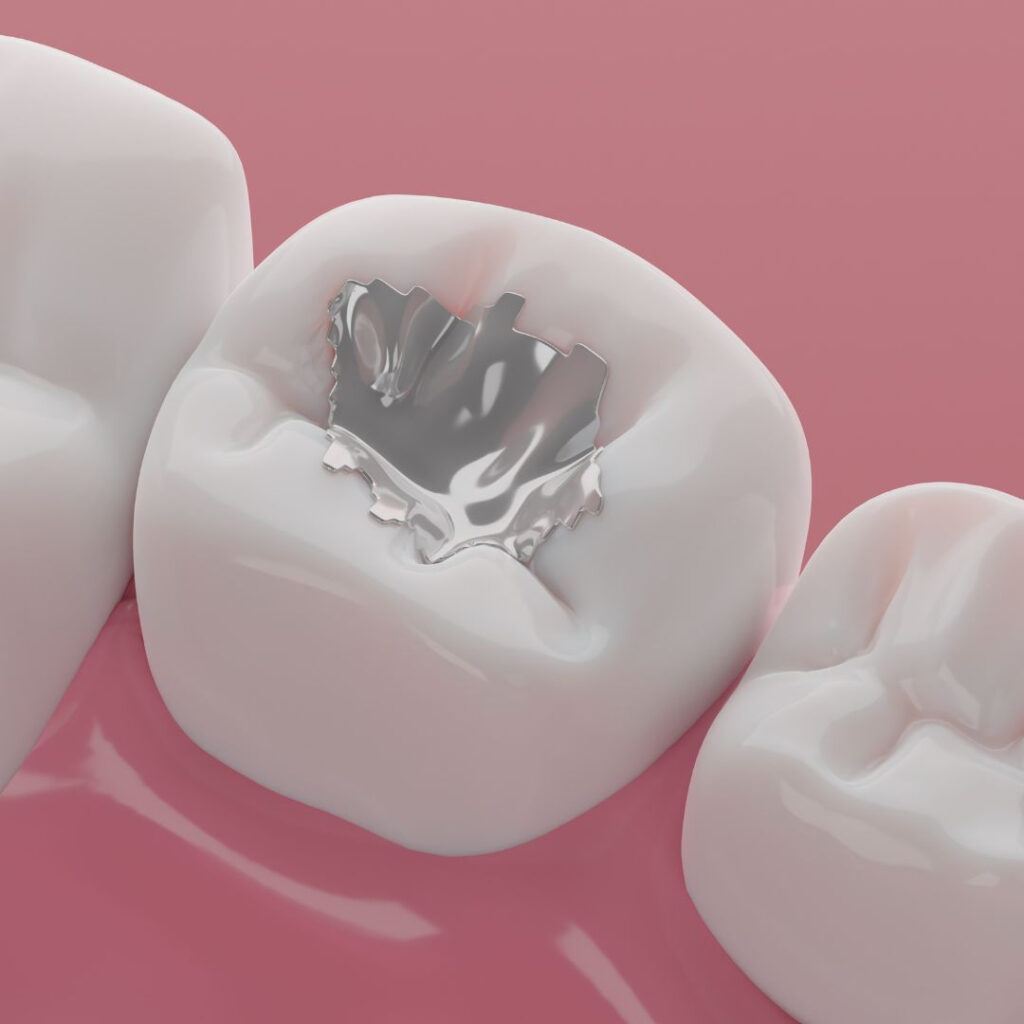 Filing’s-Silver-&-Cosmetic