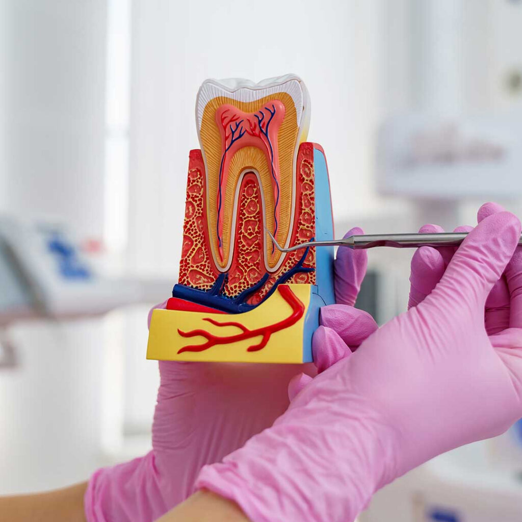 Root-Canal-Treatment