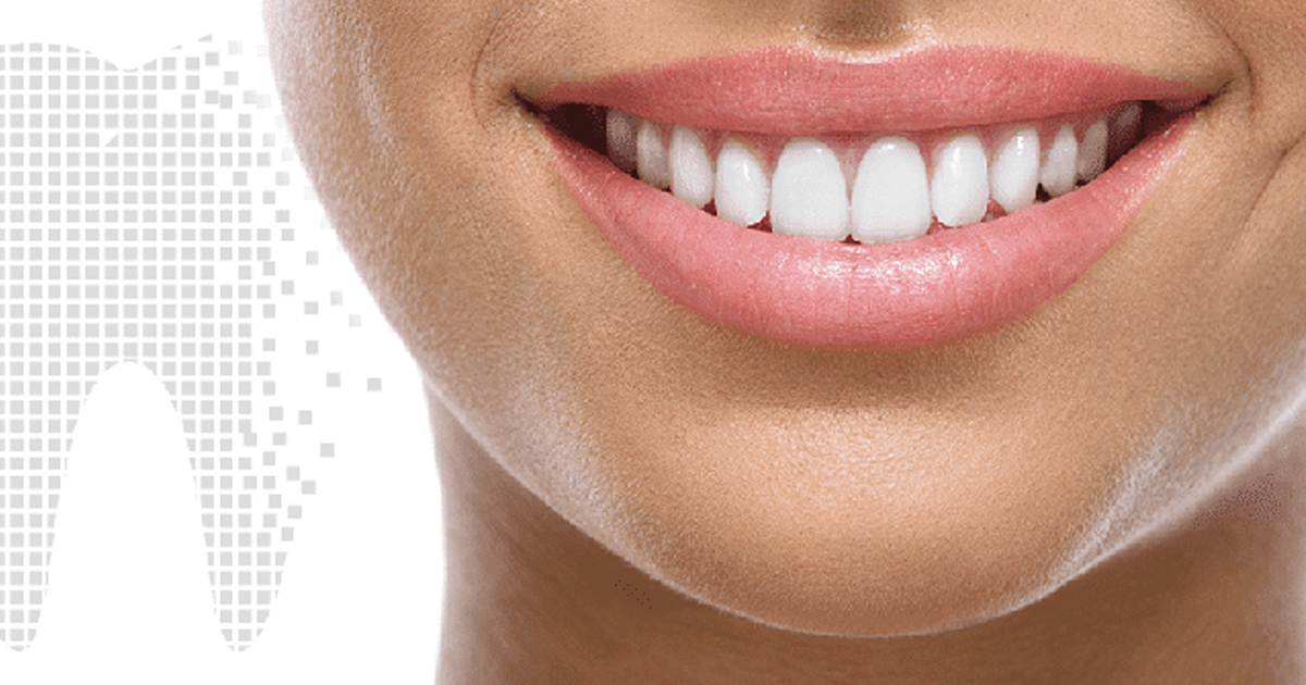 Best Smile with Dental Implants in Mayur Vihar – Rediscover Your Confidence at Dr. Budhiraja’s Ora-Dental Care Clinic