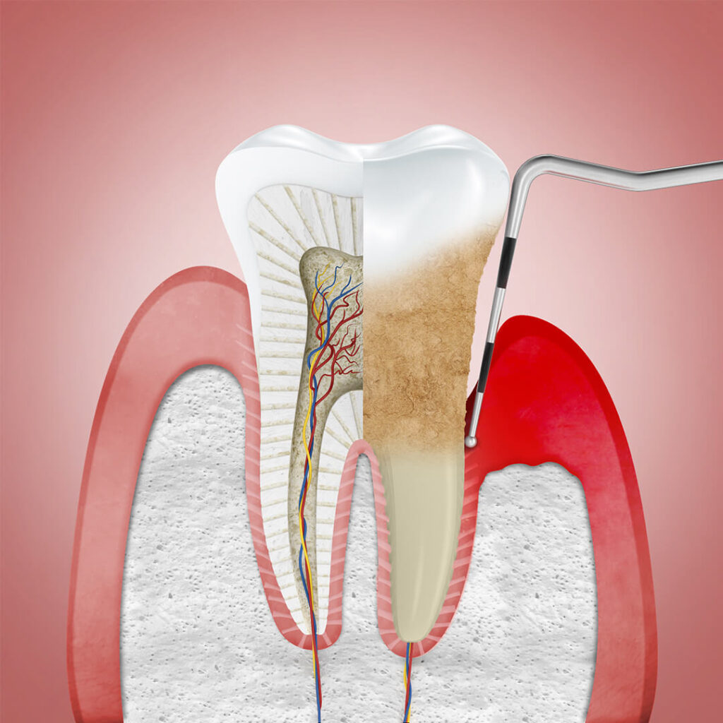 Tt-of-Oral-&-Gum-Diseases